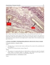 Advances in the Diagnosis and Treatment of Vasculitis