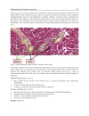 Advances in the Diagnosis and Treatment of Vasculitis