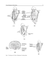 Current Concepts of Urethroplasty