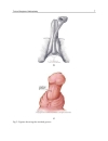 Current Concepts of Urethroplasty