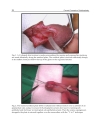 Current Concepts of Urethroplasty