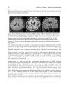 Epilepsy in Children Clinical and Social Aspects