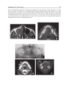 Computed Tomography Special Applications