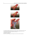 Understanding the Complexities of Kidney Transplantation