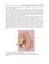 Understanding the Complexities of Kidney Transplantation