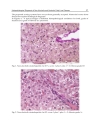 Liver Biopsy in Modern Medicine