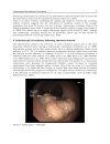 Endoscopic Procedures in Colon and Rectum