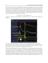 New Aspects of Ventricular Assist Devices