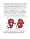 New Aspects of Ventricular Assist Devices