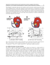 New Aspects of Ventricular Assist Devices