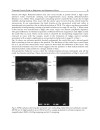 Magnesium Alloys Corrosion and Surface Treatments