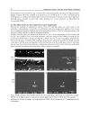 Magnesium Alloys Corrosion and Surface Treatments