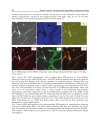 Recent Trends in Processing and Degradation of Aluminium Alloys