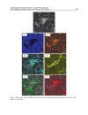 Recent Trends in Processing and Degradation of Aluminium Alloys