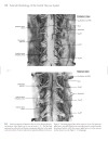 Neuroanatomy An Atlas of Structures Sections and Systems