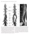 Neuroanatomy An Atlas of Structures Sections and Systems