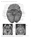 Neuroanatomy An Atlas of Structures Sections and Systems