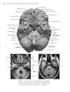 Neuroanatomy An Atlas of Structures Sections and Systems