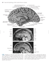 Neuroanatomy An Atlas of Structures Sections and Systems