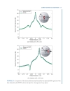 Implanted Antennas in Medical Wireless Communications