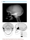 Pocket Atlas Of Radiographic Anatomy 2d ed