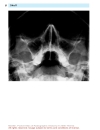 Pocket Atlas Of Radiographic Anatomy 2d ed