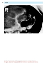 Pocket Atlas Of Radiographic Anatomy 2d ed