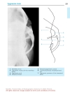 Pocket Atlas Of Radiographic Anatomy 2d ed