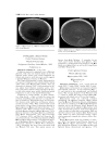 GEOLOGY AND VERTEBRATE PALEONTOLOGY OF THE EARLY PLIOCENE SITE OF KANAPOI NORTHERN KENYA