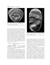 GEOLOGY AND VERTEBRATE PALEONTOLOGY OF THE EARLY PLIOCENE SITE OF KANAPOI NORTHERN KENYA