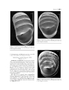 GEOLOGY AND VERTEBRATE PALEONTOLOGY OF THE EARLY PLIOCENE SITE OF KANAPOI NORTHERN KENYA