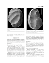 GEOLOGY AND VERTEBRATE PALEONTOLOGY OF THE EARLY PLIOCENE SITE OF KANAPOI NORTHERN KENYA