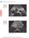 Color Atlas of Ultrasound Anatomy