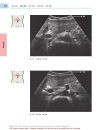 Color Atlas of Ultrasound Anatomy