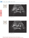 Color Atlas of Ultrasound Anatomy