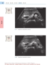 Color Atlas of Ultrasound Anatomy