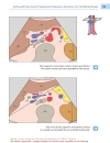 Color Atlas of Ultrasound Anatomy