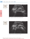 Color Atlas of Ultrasound Anatomy