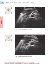 Color Atlas of Ultrasound Anatomy