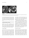 Neurological Foundations of Cognitive Neuroscience