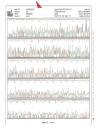 Bioinformatics Sequence and Genome Analysis