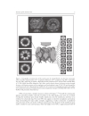 Nuclear Import and Export in Plants and Animals