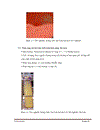 Serratia mercescens