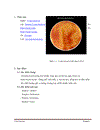 Serratia mercescens