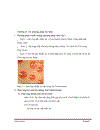 Serratia mercescens