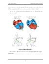 Thiết kế chế tạo thiết bị đó ECG giao tiếp với máy tính