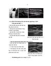 Đánh giá hiệu quả của phương pháp tiêm corticoid dưới hướng dẫn của siêu âm trong điều trị viêm quanh khớp vai thể đau khớp vai đơn thuần và thể đau vai cấp