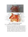 Nghiên cứu đặc điểm lâm sàng và chụp cắt lớp vi của chấn thương tháp mũi