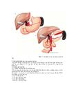 Nghiên cứu triệu chứng lâm sàng cận lâm sàng ở bệnh nhân cắt toàn bộ dạ dày do ung thư tại bệnh viện Việt Đức từ năm 2006 tới 201