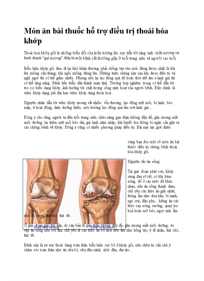 Hỡ trợ điều trị thoái hóa khớp